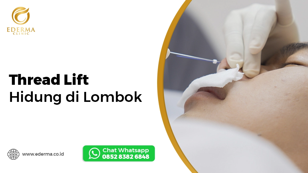 Thread Lift Hidung di Lombok