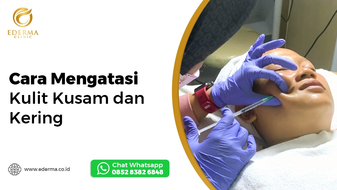 Cara Mengatasi Kulit Kusam dan Kering