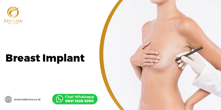 Tindakan - Breast Implant