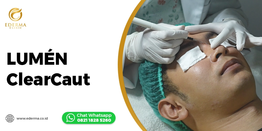 LUMÉN ClearCaut