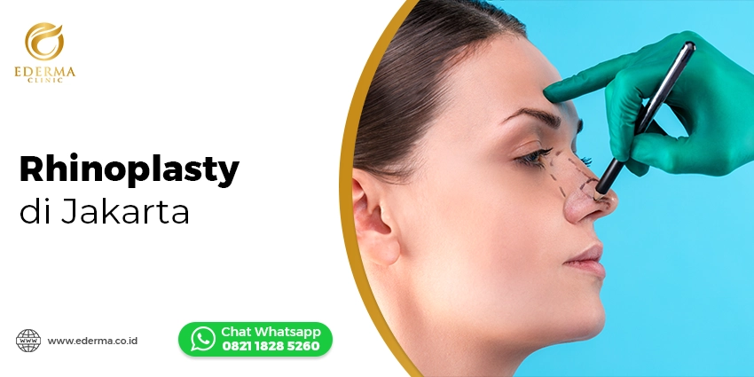 Operasi Bedah Plastik