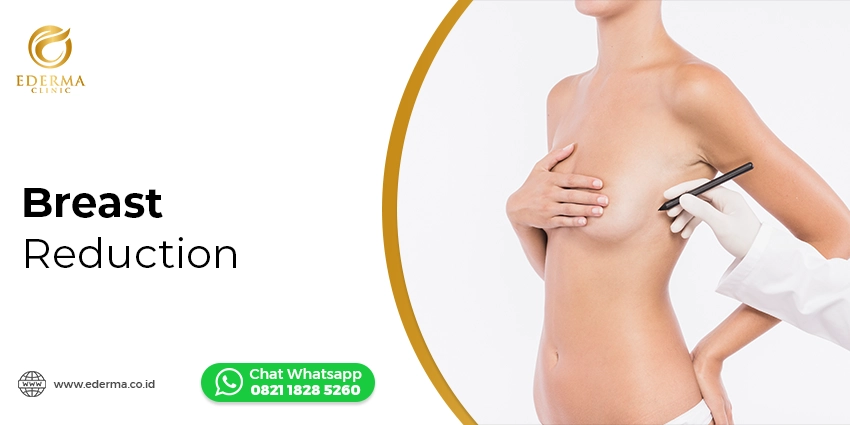 Tindakan - Breast Reduction