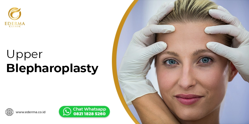 Tindakan - Upper Blepharoplasty