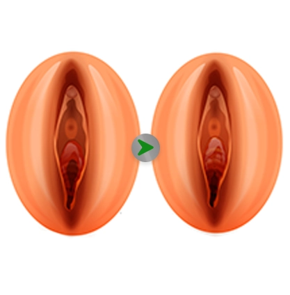 Before After - Operasi Selaput Dara Terbaik dan Aman di Jakarta 001