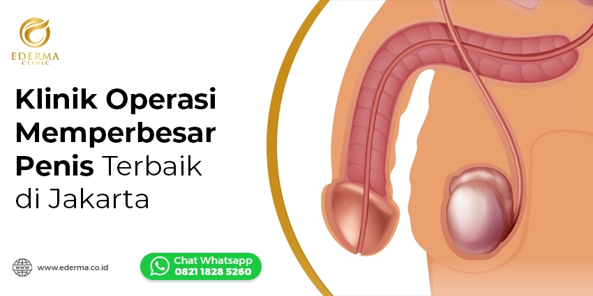 Klinik Operasi Memperbesar Penis Terbaik di Jakarta