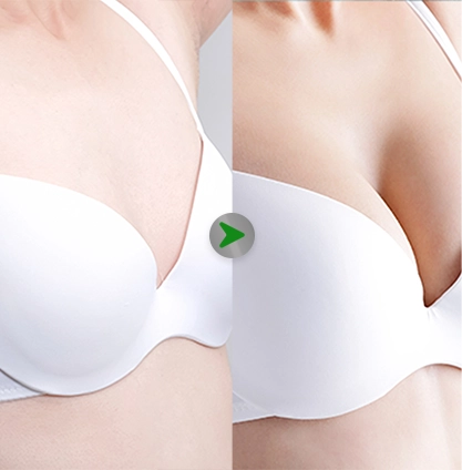 Before After - Breas 001
