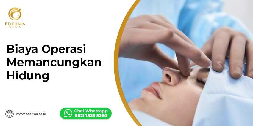 Cover - Biaya Operasi Memancungkan Hidung