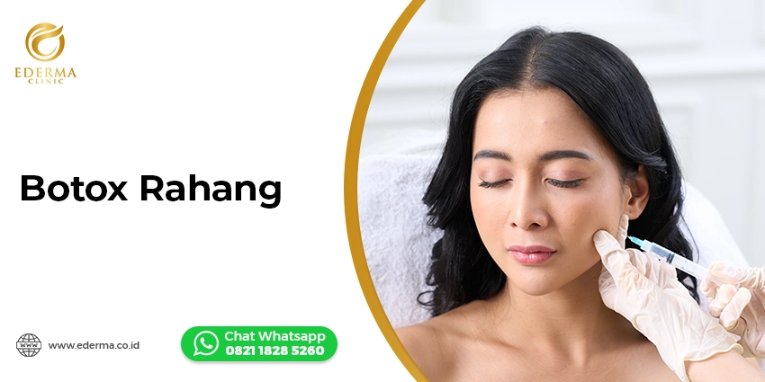 Botox Rahang: Solusi Wajah Tirus, Simetris, dan Natural di Ederma Clinic