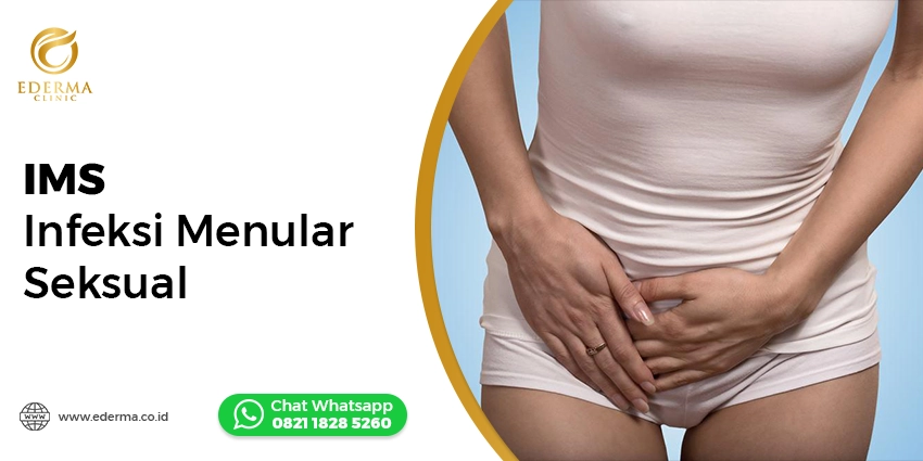 Tindakan - Gejala IMS Awal Pada Wanita