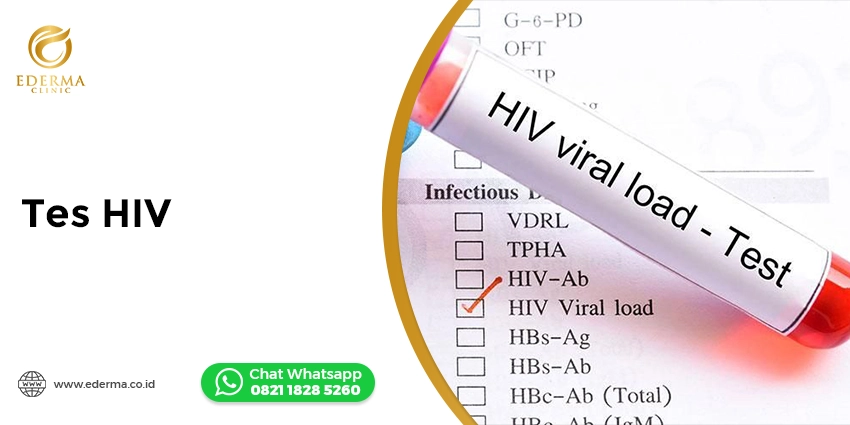 Tindakan - Harga Tes HIV