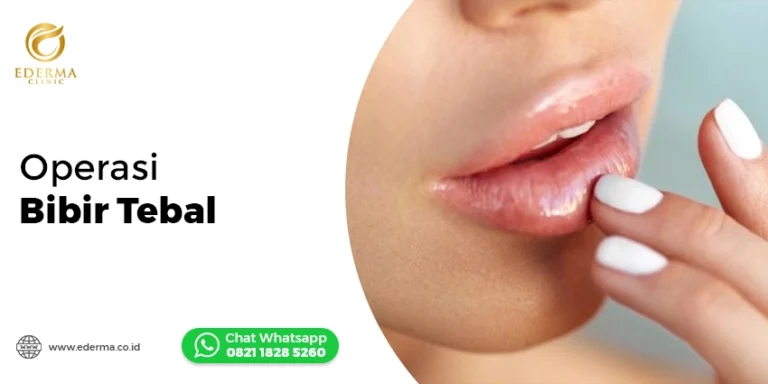 Operasi Bibir Tebal di Ederma Clinic: Solusi Senyum Natural & Wajah Proporsional
