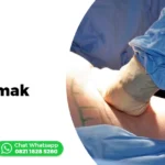 Cover - Operasi Sedot Lemak