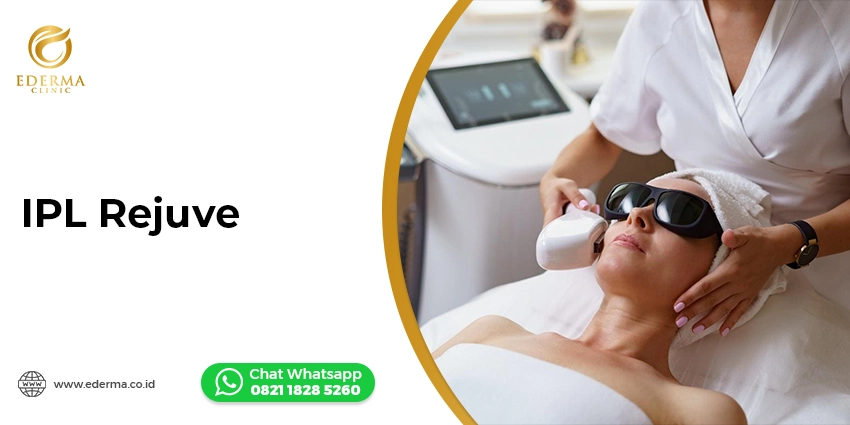 IPL Rejuve: Rahasia Kulit Cerah, Glowing, dan Awet Muda di Ederma Clinic