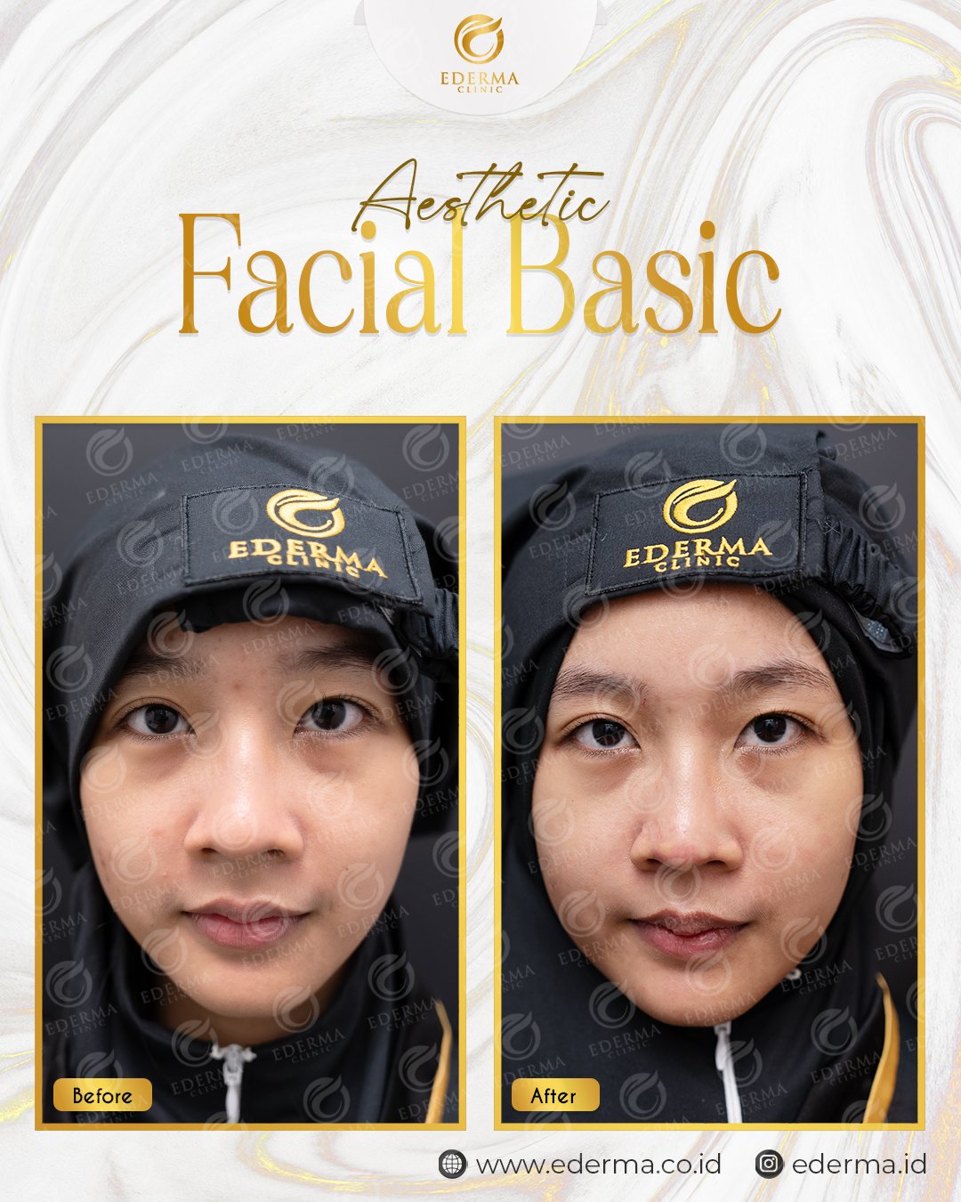 FACIAL BASIC