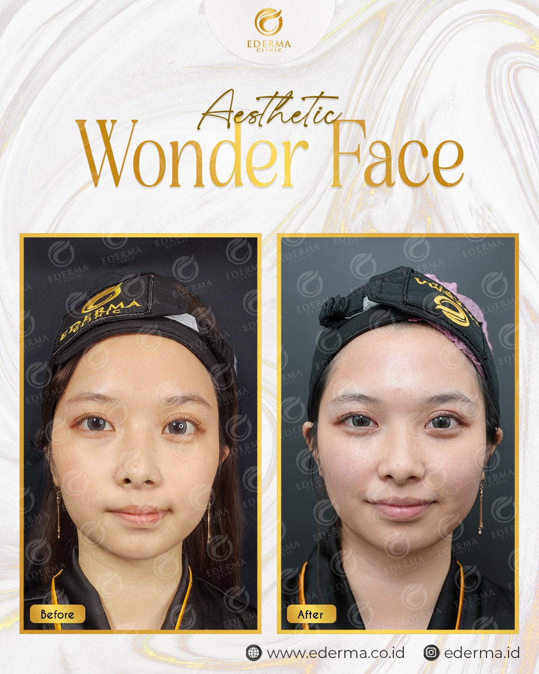 WONDERFACE