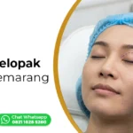 operasi-blepharoplasty-semarang