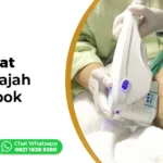 HIFU Wajah di Lombok Ederma Clinic