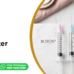 botox vs skinbooster