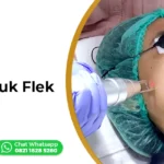 Laser untuk Flek Hitam