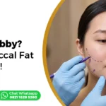buccal fat removal wajah bulat pipi chubby Ederma Clinic