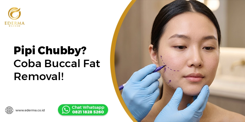 buccal fat removal wajah bulat pipi chubby Ederma Clinic