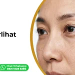 Wajah Terlihat Lebih Tua