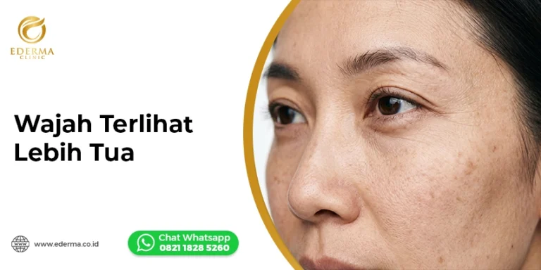 Wajah Terlihat Lebih Tua dari Umur Asli? Bisa Jadi Ini Penyebabnya