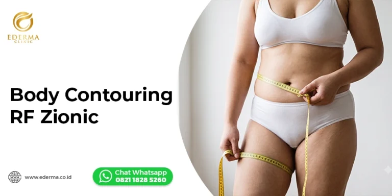 Body Contouring RF Zionic: Solusi Perut Buncit & Paha Besar