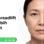 cheek threadlift pipi turun wajah terangkat Ederma Clinic