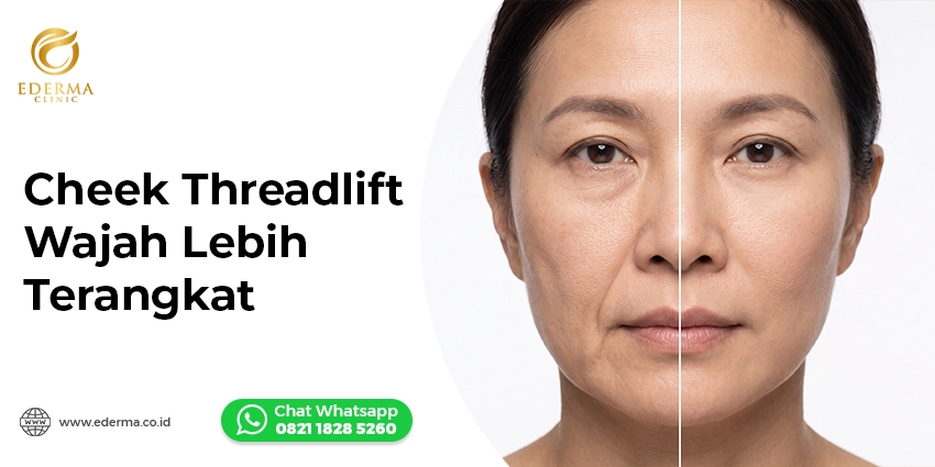 cheek threadlift pipi turun wajah terangkat Ederma Clinic