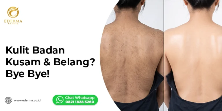 Body Peeling: Solusi Kulit Badan Kusam dan Belang