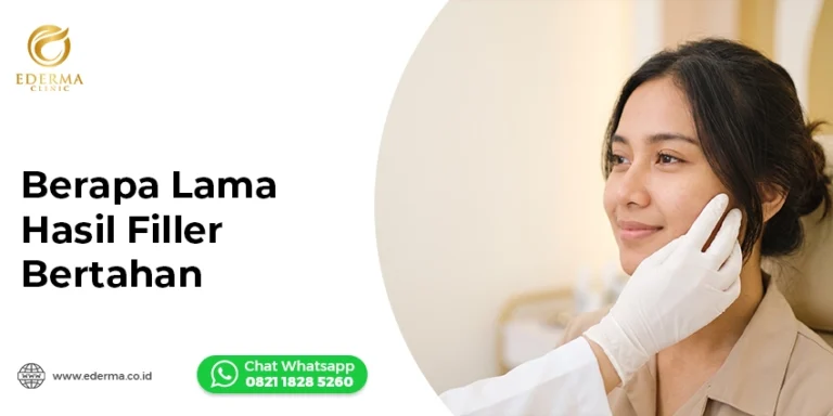Berapa Lama Hasil Filler Bertahan? Kenali Faktornya