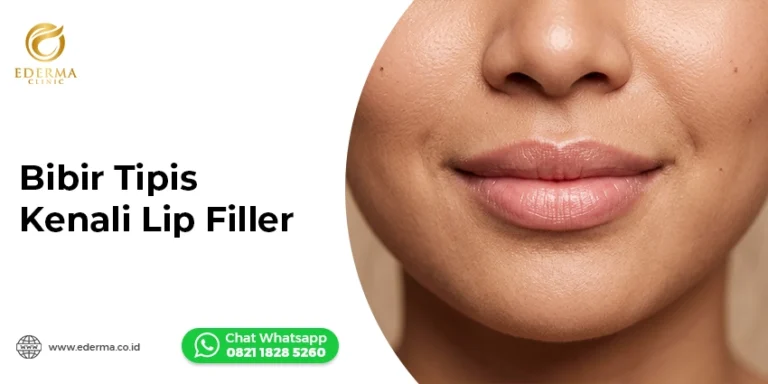 Bibir Tipis? Kenali Lip Filler Bibir Jadi Lebih Proporsional