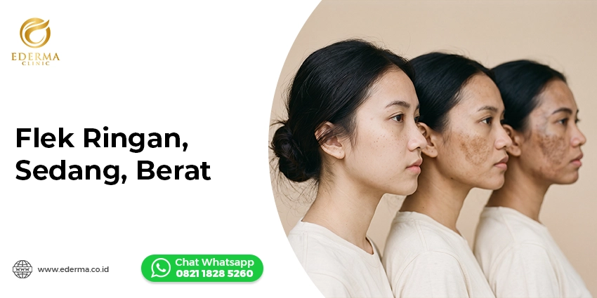 treatment flek hitam